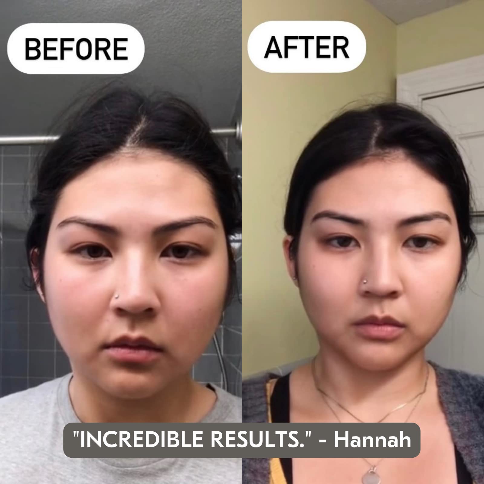 Mount Lai - The Stainless Steel Gua Sha Facial Lifting Tool | Cooling Gua Sha to Sculpt Facial Features + Release Tension