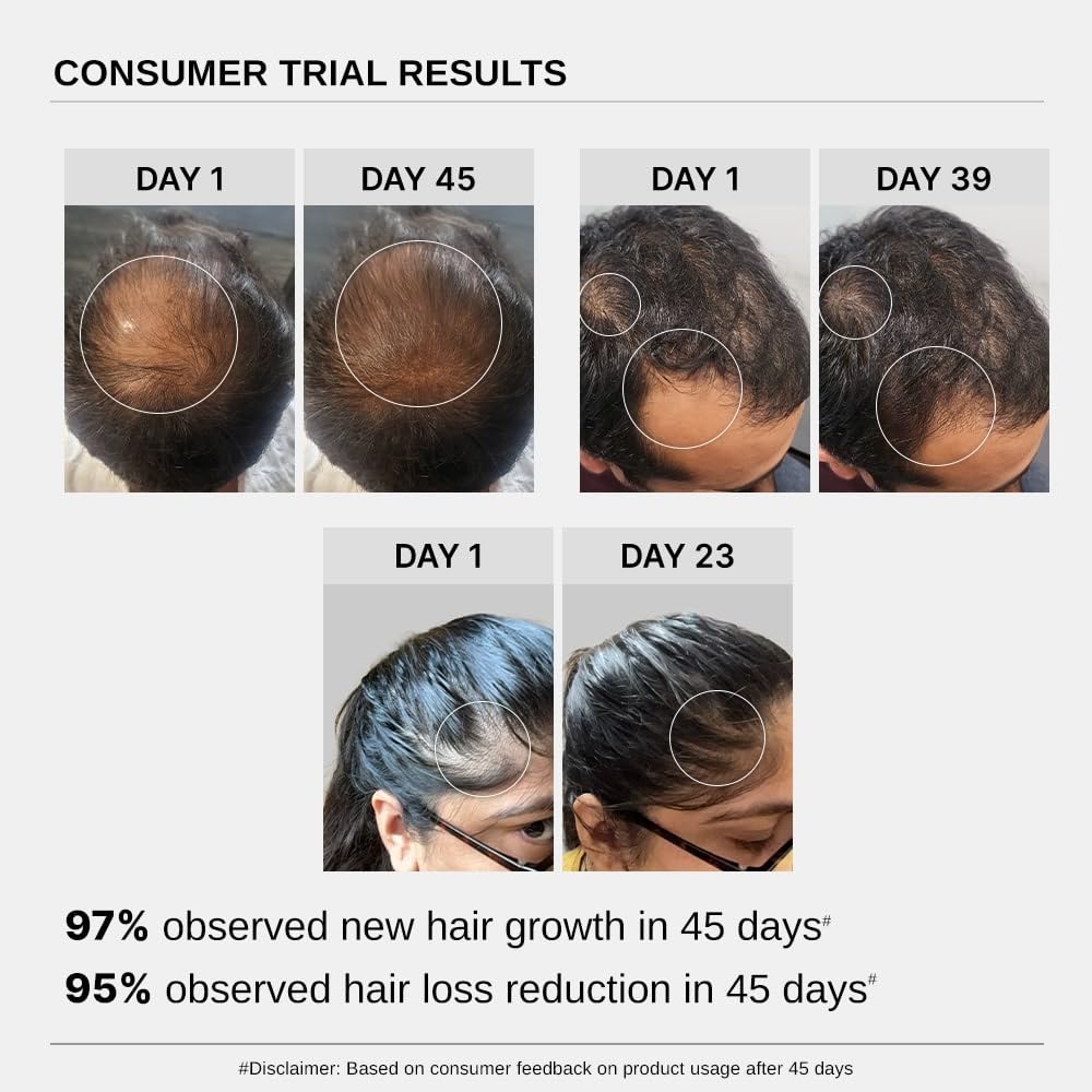 Bare Anatomy Advanced Hair Growth Serum| 3% Redensyl - 2x Better Results than Minoxidil | + 4% Anagain + 3% Baicapil | Rosemary, Biotin | Hair growth & Hair fall control serum for Women & Men | 30mL