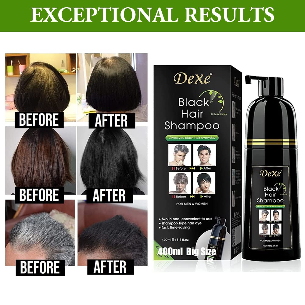 Dexe Hair Dye Shampoo 14.1 Fl Oz, Gray Hair Coverage, Black Hair Dye, Hair Color Shampoo, Black Hair Shampoo for Men & Women