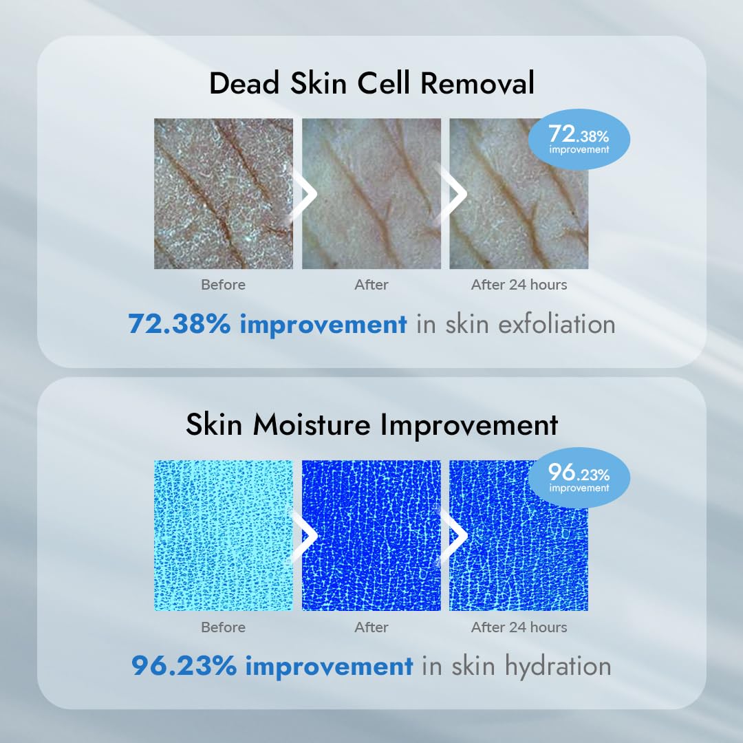 VILLAGE11FACTORY AHA 12% Body Lotion, Korean Body Cream, Exfoliating & Rejuvenating Formula with 12% Glycolic Acid and Hyaluronic Acid. Unscented, Paraben Free. 10.6 Oz