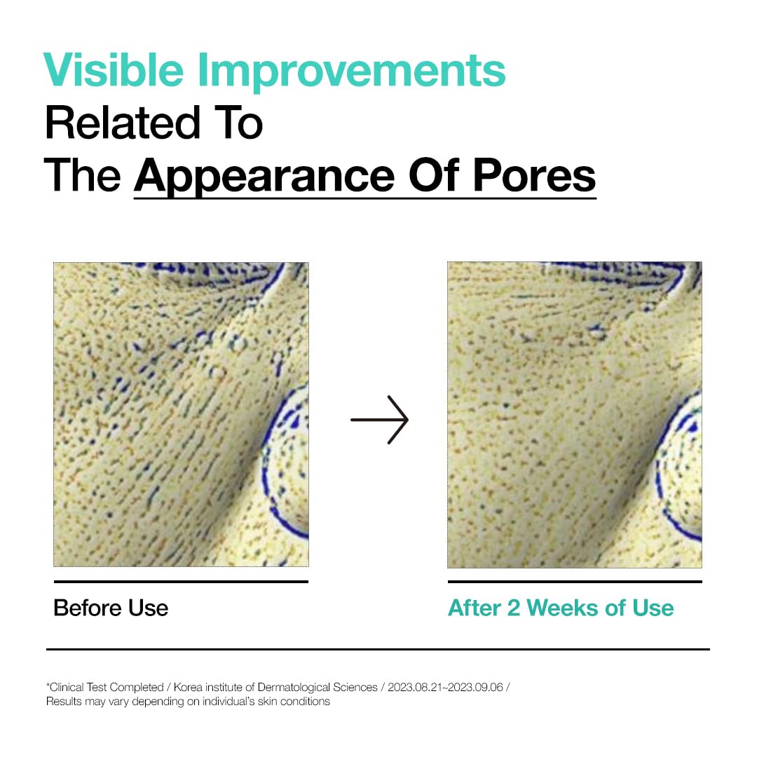 ANUA BHA 2% Gentle Exfoliating Toner, Mild Facial Exfoliant, Salicylic Acid for Pores and Sebum, Teatree Extract, Hyaluronic Acid, Ceramides (150ml / 5.07 fl.oz.)