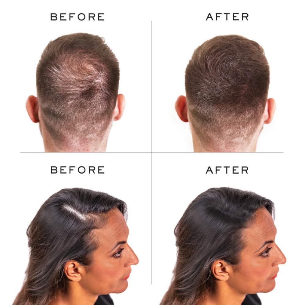 Nanogen Keratin Hair Fibers to Hide Bald Spots - Dark Brown 15 grams