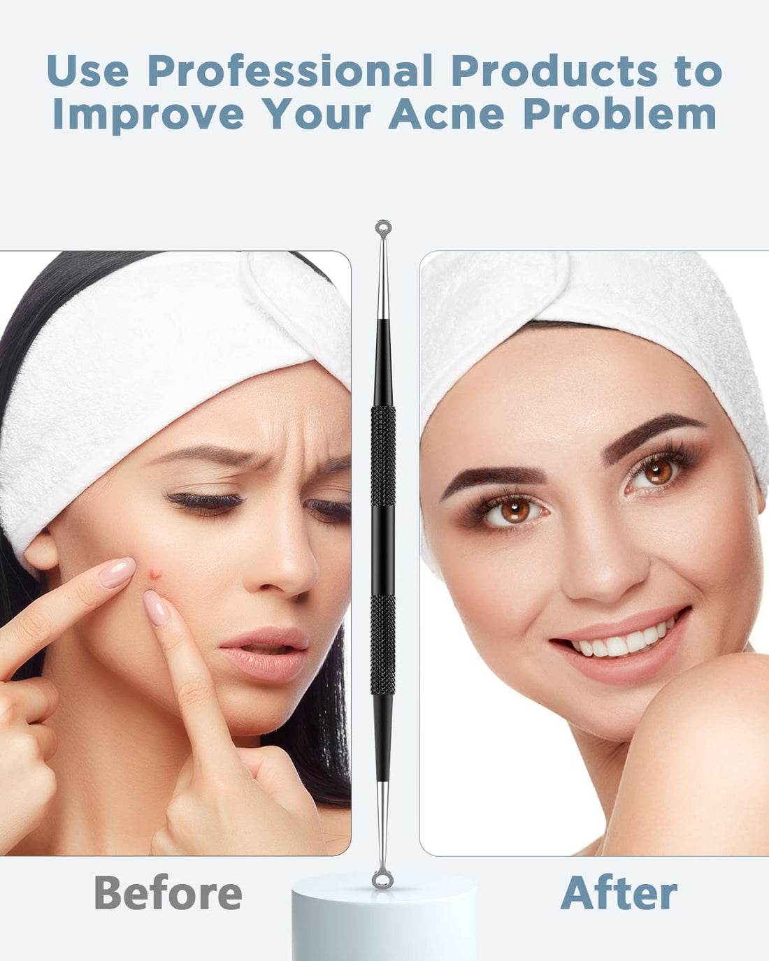 TAYTHI 5Pcs Black: Bestope Blackhead Remover Pimple Comedone Extractor Tool Best Acne Removal Kit - Treatment For Blemish, Whitehead Popping, Zit Removing For Risk Free Nose Face Skin Wi