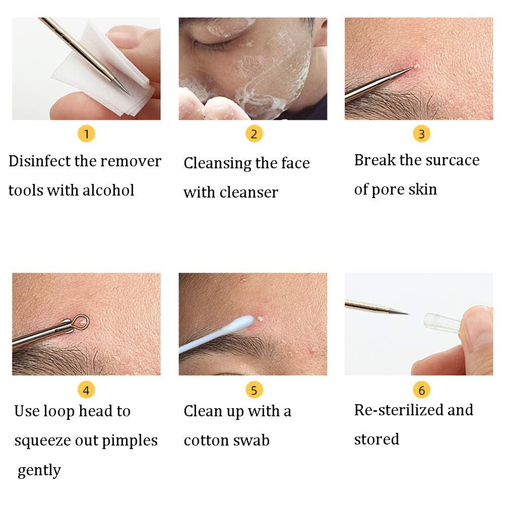 8 Pcs Stainless Steel Blackhead Remover Comedone Pimple Extractor Tool Kit with Metal Case for Pimples, Blackheads, Zit Removing for Face Nose