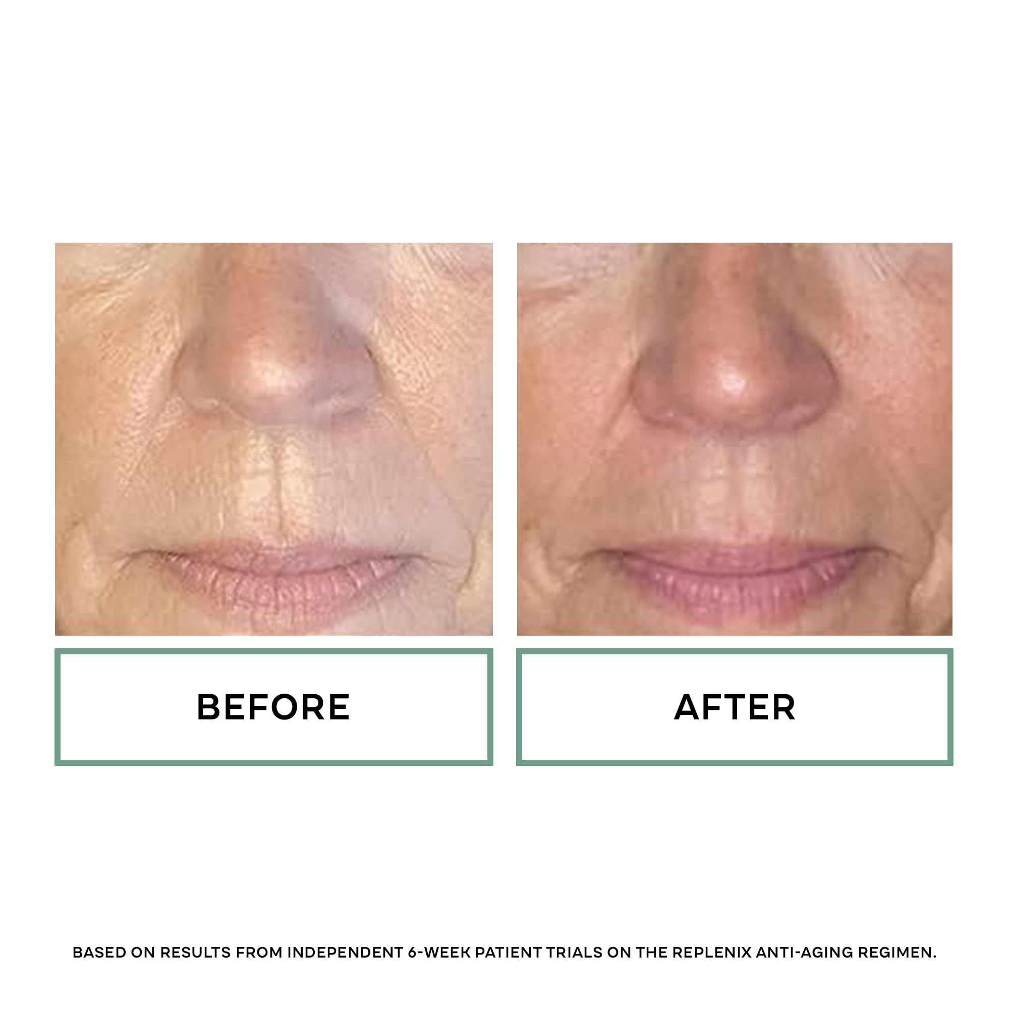 Replenix RetinolForte Treatment Serum 10X, 1 Oz