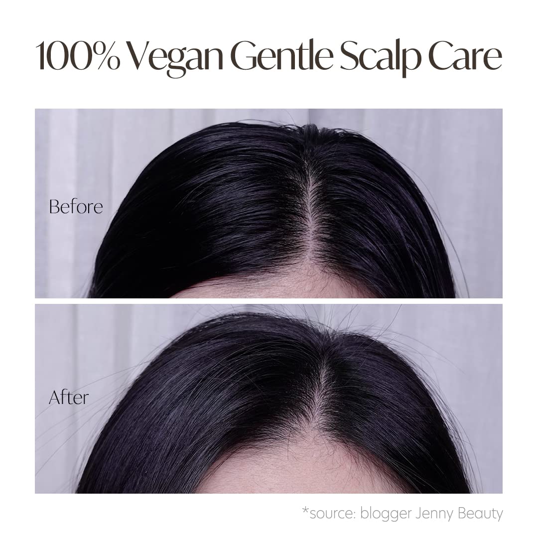 d'alba Piedmont Professional Repairing Scalp Therapy Serum Shampoo 275ml, Mild and Vegan Formula, Gentle Hair and Scap Treatment