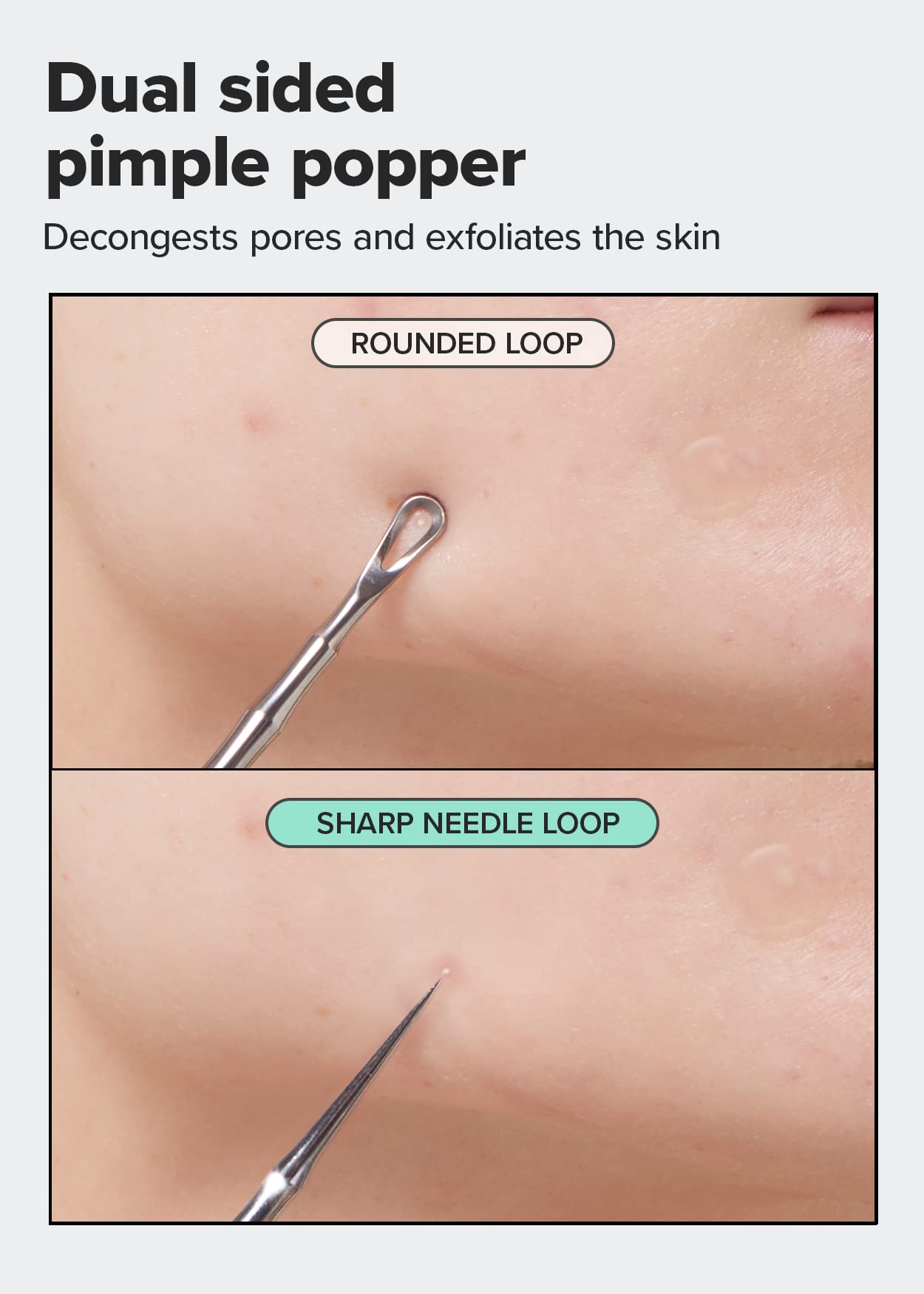 I DEW CARE Dual-Tip Pimple Tool - Proper Popper | Blackhead Remover, Blemish Exfoliating, Professional Acne Squeezer, Comedone Zit Extractor for Women, Stainless Steel, Mother's Day, 1ea