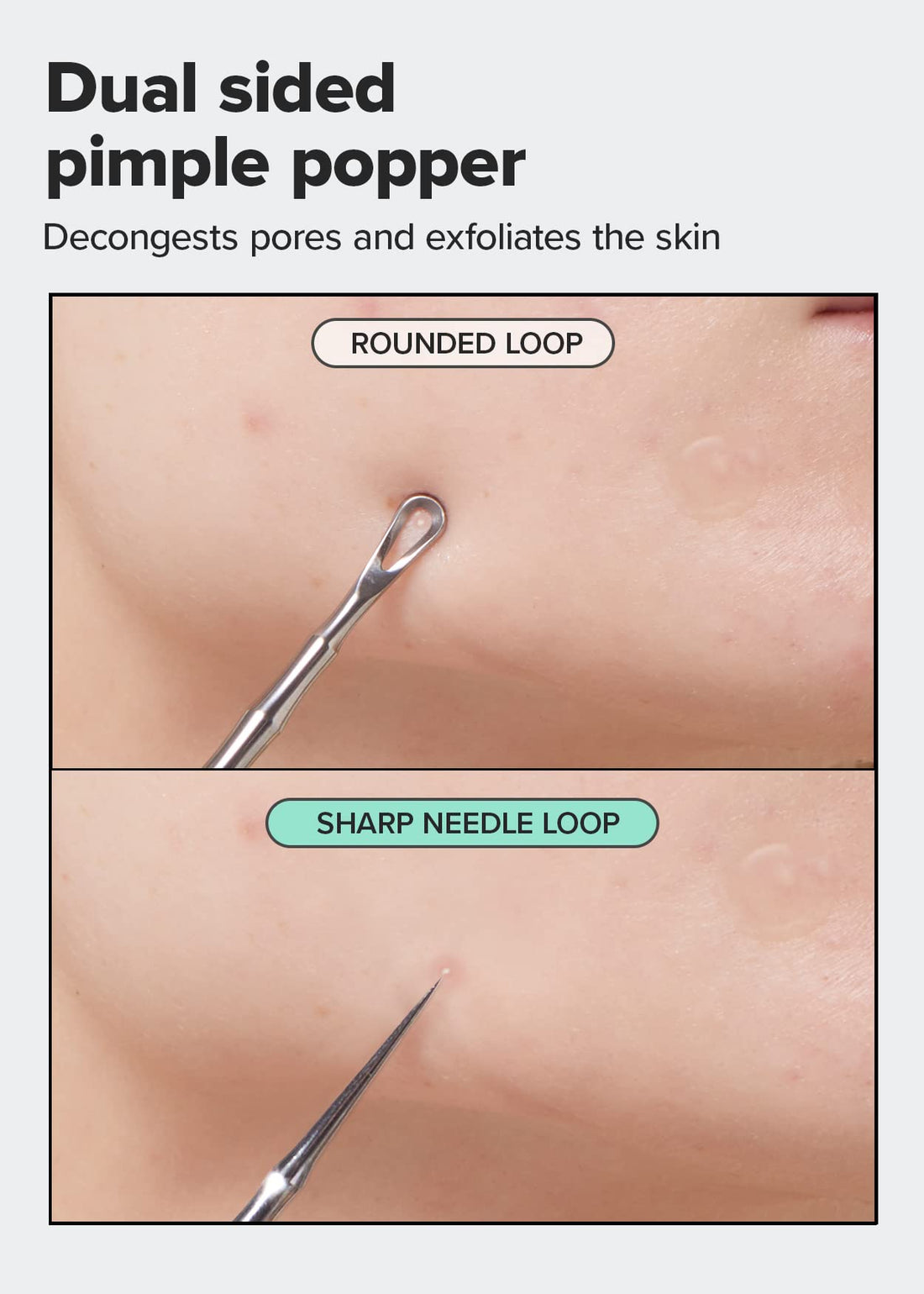 I DEW CARE Dual-Tip Pimple Tool - Proper Popper | Blackhead Remover, Blemish Exfoliating, Professional Acne Squeezer, Comedone Zit Extractor for Women, Stainless Steel, Mother's Day, 1ea