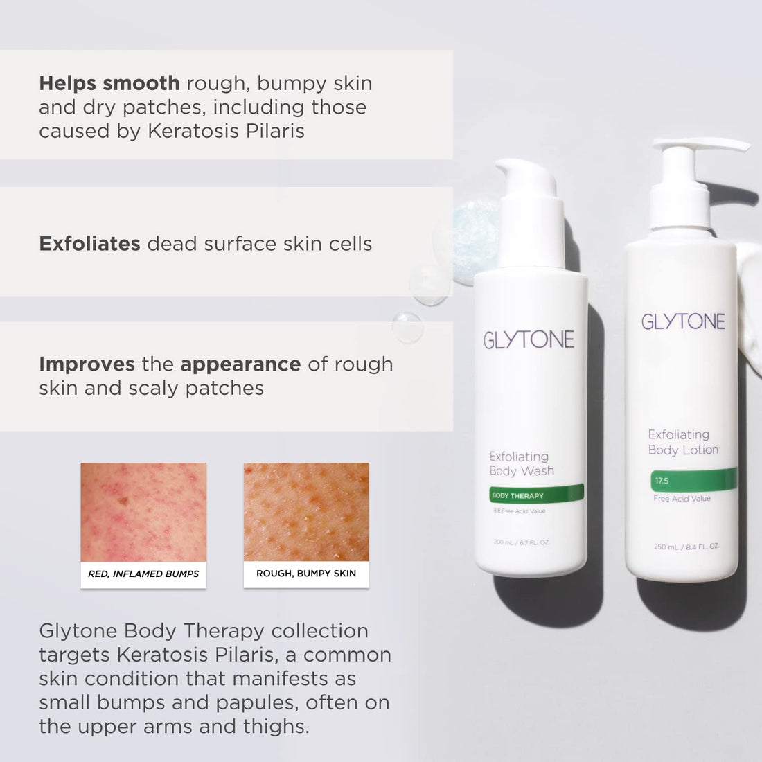 Glytone Glycolic Acid Exfoliating Body Lotion, Keratosis Pilaris Lotion For Rough And Bumpy Skin, Dry Skin Lotion, 17.5% PFAV Glycolic Acid, Fragrance Free Body Lotion, Skin Care Moisturizer 8.4 Fl.Oz