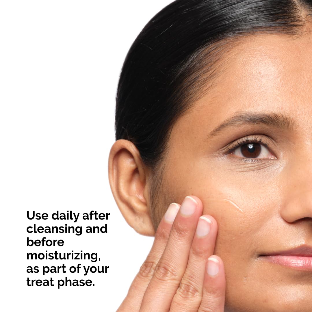 The Ordinary Aloe 2% + NAG 2% Solution, Soothes Skin and Targets Post-Acne Marks, 1 Fl Oz