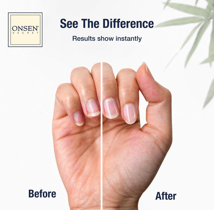 Onsen Nail & Cuticle Cream Treatment w/Japanese Tsubaki, Jojoba & Lavender Oil, Shea Butter – Strengthens Nails, Softens Cuticles - Daily Repair Care (2 Count/30 ml)