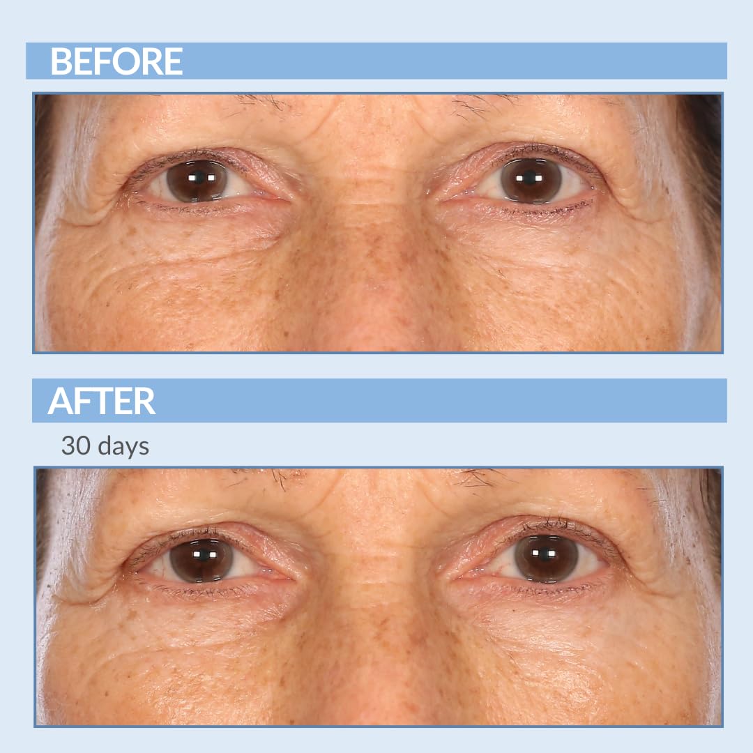 Serious Skincare - Retinol Face and Neck 3 Piece Kit - Anti-Aging for Fine Lines & Wrinkles - A Force XR Serum 1 oz - 4 Million IU A Cream XR Moisturizer 2 oz - A Wash Gel-to-Foam Cleanser 4 oz