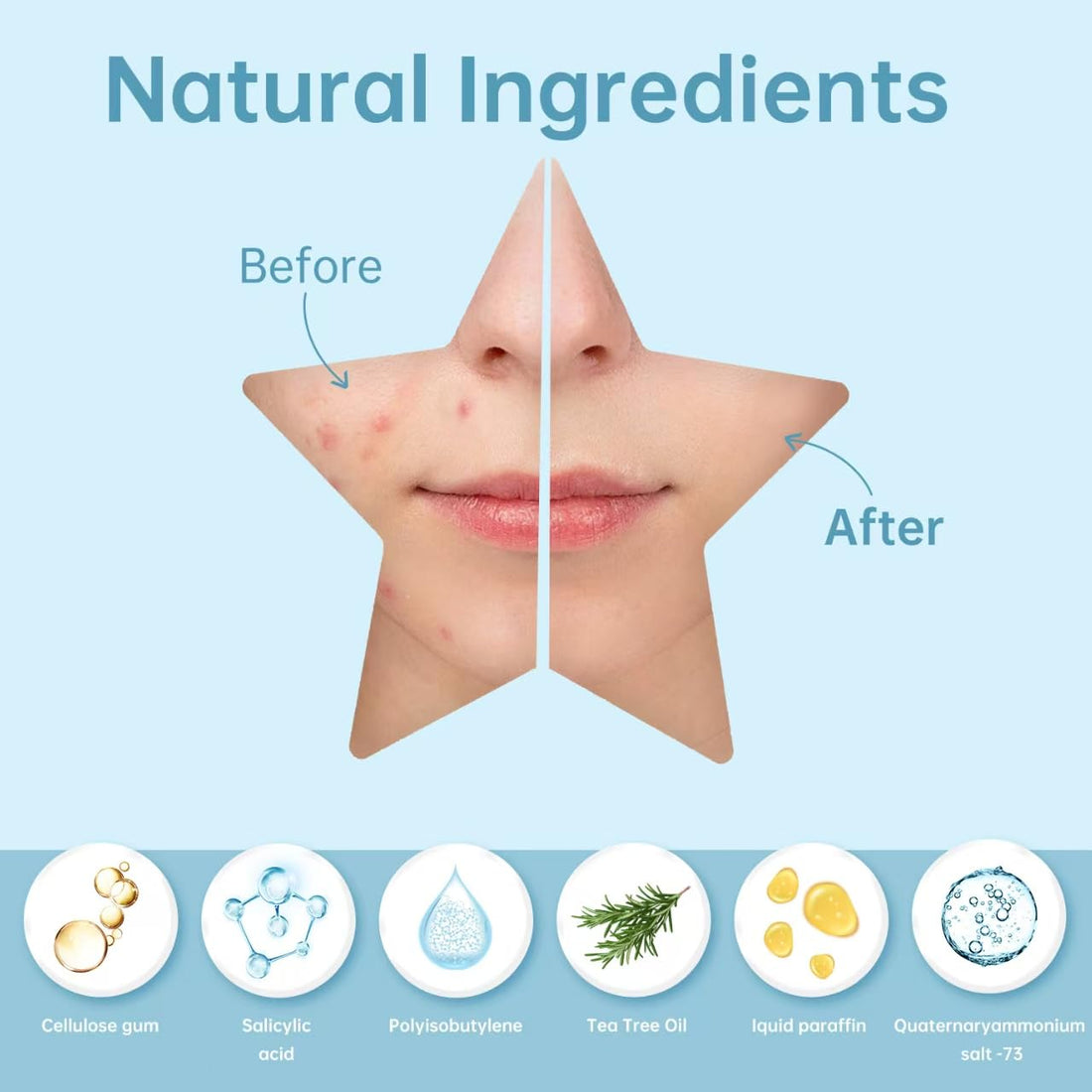 REDANHA 200 Counts Star Patch for Face, Hydrocolloid Acne Pimple Patch with Tea Tree Oil for Party Gift Covering Zits Blemishes