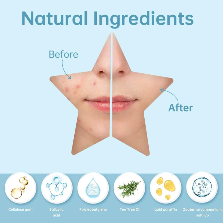 REDANHA 200 Counts Star Patch for Face, Hydrocolloid Acne Pimple Patch with Tea Tree Oil for Party Gift Covering Zits Blemishes
