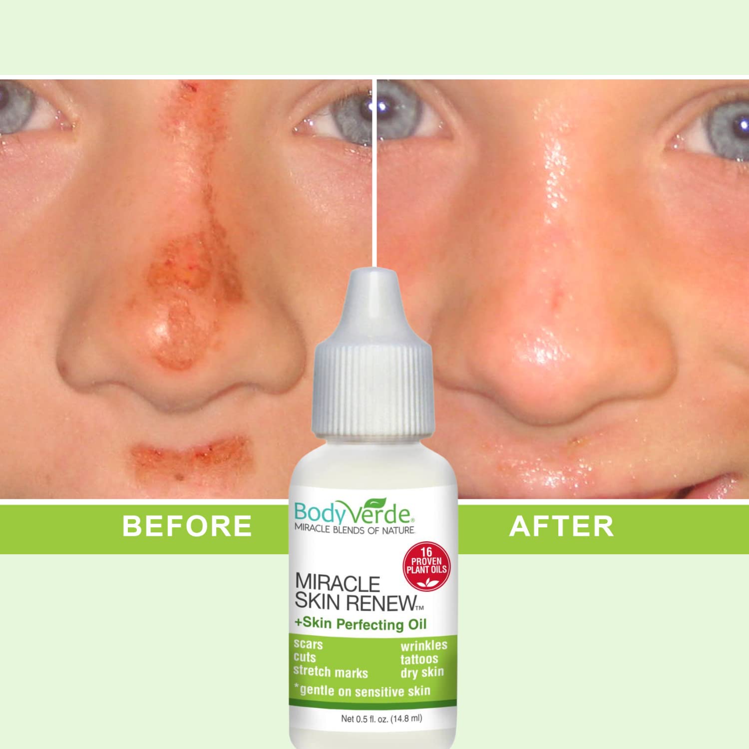 BodyVerde Miracle Skin Renewal Natural Skin Care Product, Skin Repair for Children and Adults, Healing Jojoba Oil and Coconut Oil Serum, Skin Perfecting Oil, 16 Proven Plant Oils, 0.5-Ounce