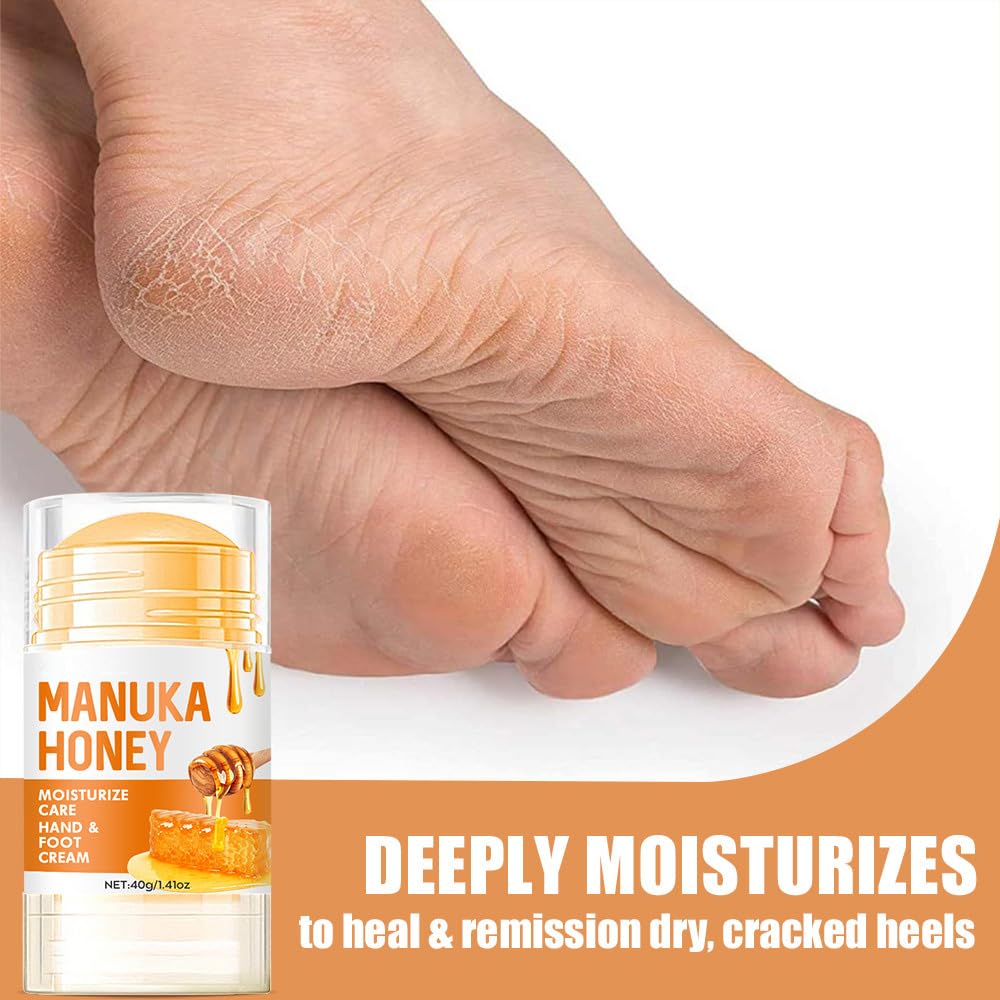 60% Urea Cream - Manuka Honey Foot Hand Cream Stick for Dry & Cracked Feet Elbows Knees Heels Hands, Hydrates & Nourish Foot Care for Softening and Moisturizing, Removing Calloused Skin, 1.41 oz