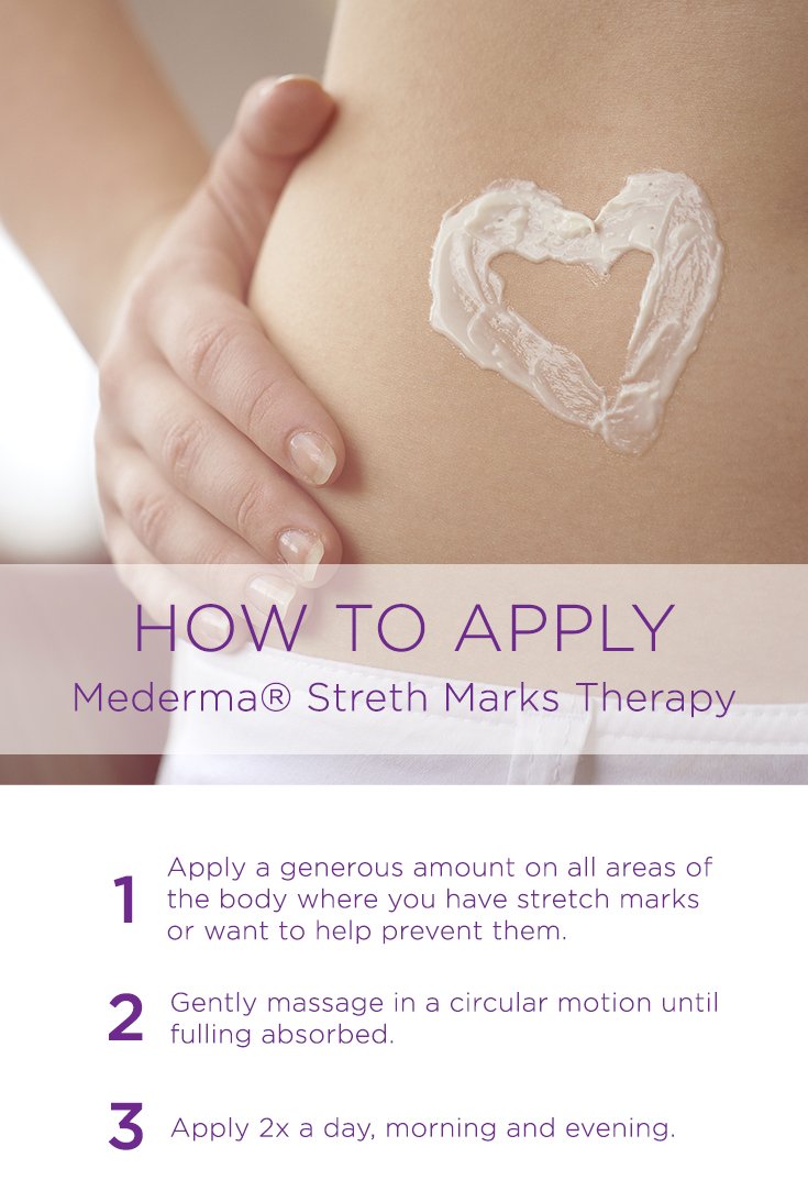 Mederma Stretch Marks Therapy, Hydrates to Help Prevent Stretch Marks, Clinically Shown to Produce Noticable Improvement in 4 Weeks, Dermatologist Recommended, Ivory, 5.29 Ounce