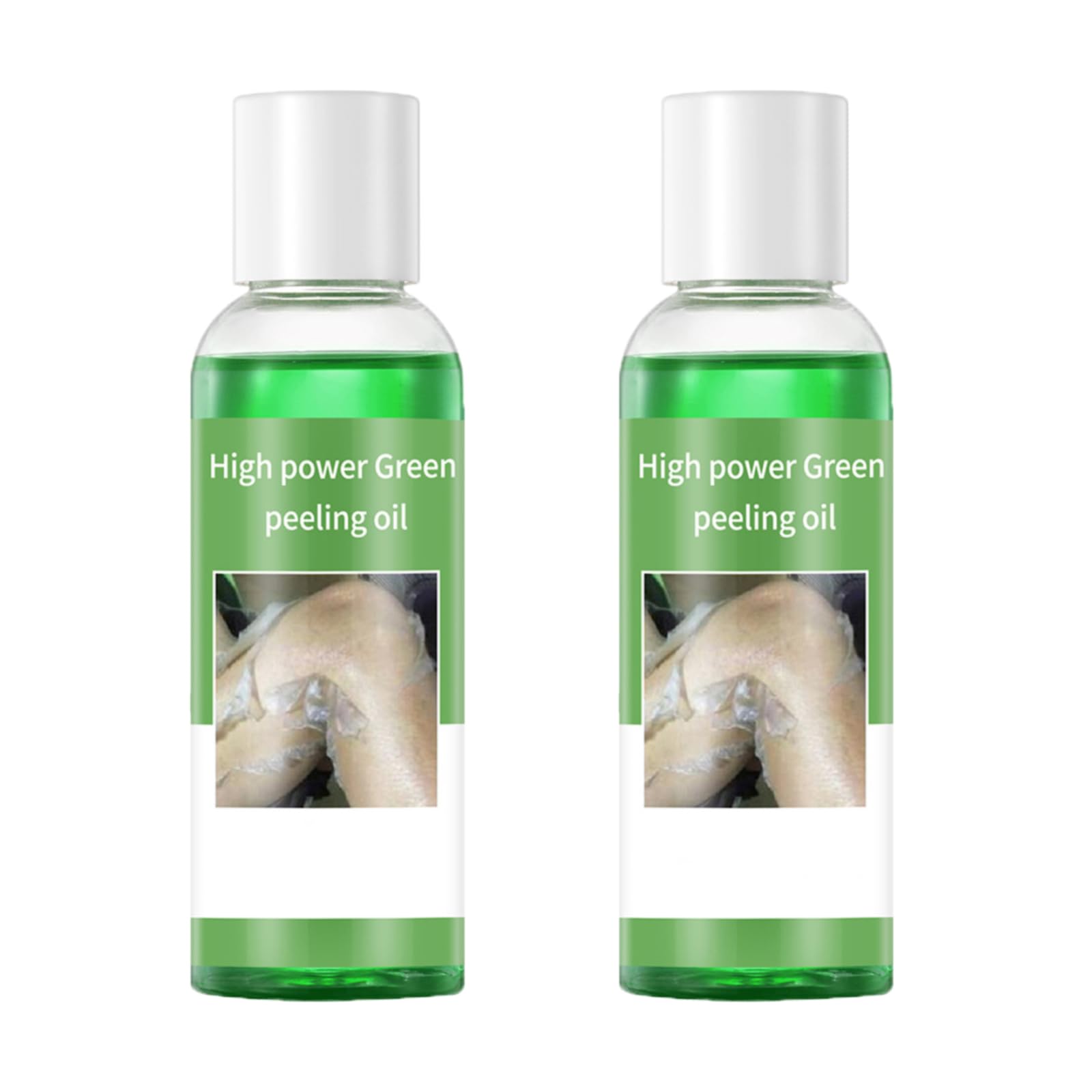 Generic Peeling Oil for Dark Skin, Green Peeling Oil Extra Strength, Extra Strong Peeling Oil for Hand, Feet and All Body, Chemical Peel for Face at Home,110ML/3.88Oz (2 PCS)