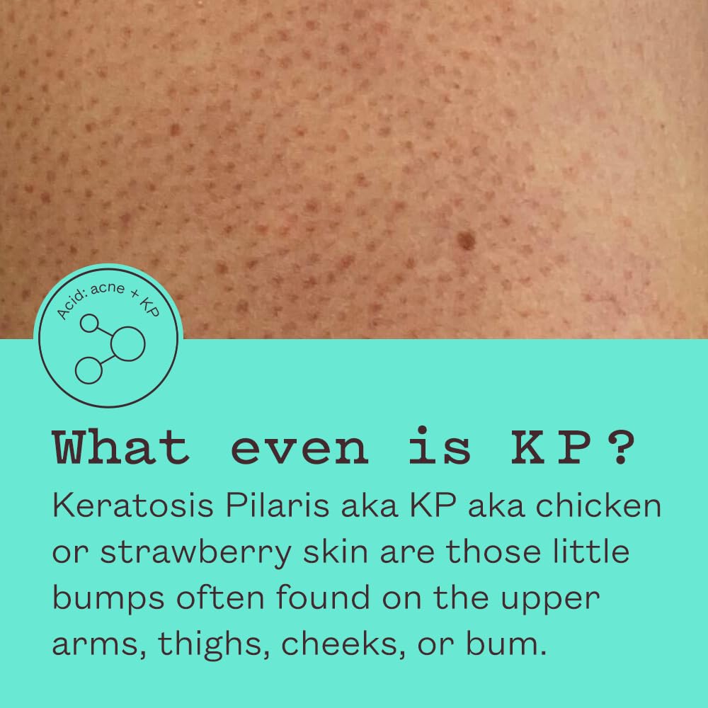 frank body Triple Acid Body Wash | Vegan, Cruelty Free Exfoliating Body Wash | Made with Glycolic Acid & Lactic Acid To Tackle Body Acne & Breakouts | 8.45 fl oz / 250 mL