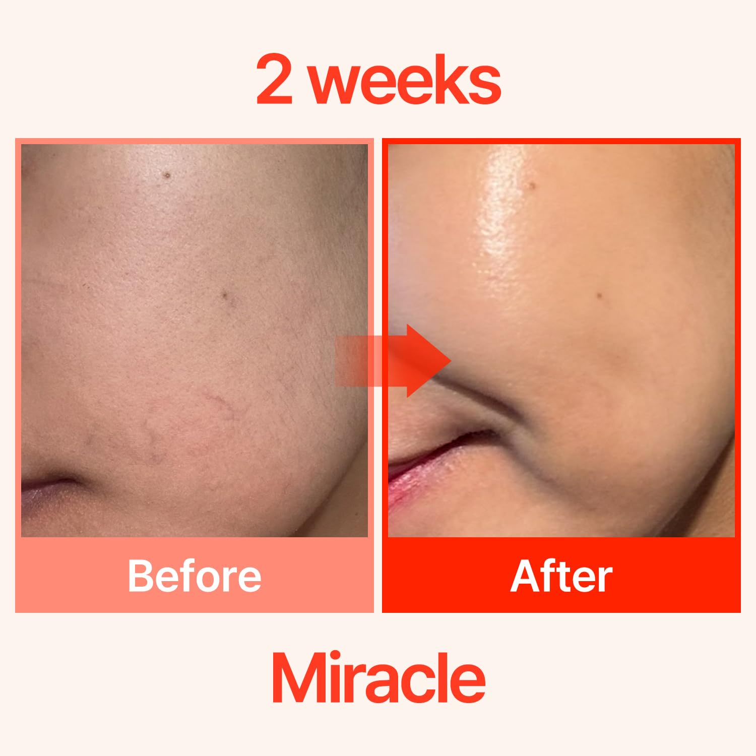 COSNORI PDRN-Shot 675 - Korea Facial Serum with 675,000 high purity spicules - Turnover K-Beauty Face Serum with High Nutrition Salmon DNA PDRN - Intensive facial first essence (50ml / 1.69 fl. oz.)