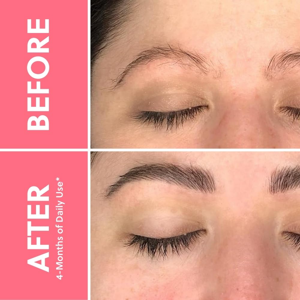 ForChics ForBrow Eyebrow Growth Serum For Thicker Brows - Natural & Organic Conditioner For Fuller and Thick Eyebrows | Vegan & Cruelty-Free Formula | New Innovative Peptides - [0.10 fl. oz/ 3ml]