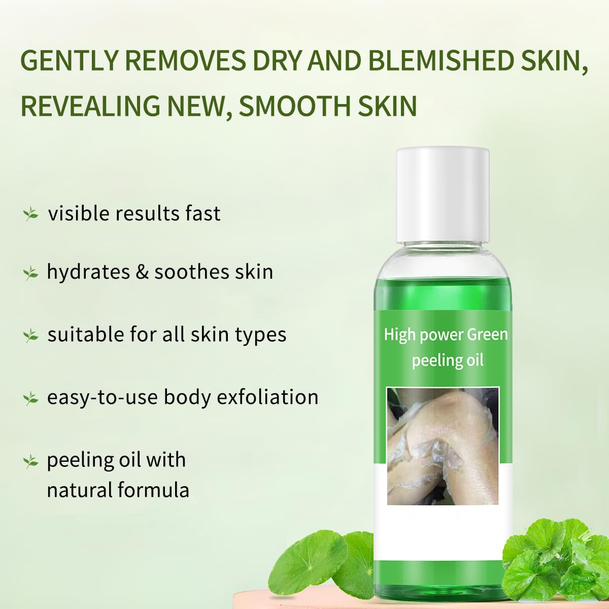 IREV Peeling Oil for Dark Skin, Green Peeling Oil, Facial Peels with Hyaluronate,Exfoliating Peel Solution for Body, Chemical Peel At Home for Dark Spots, Body Exfoliant Peels 3.66 OZ