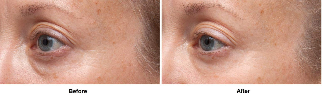Dr Dennis Gross Ferulic + Retinol Triple Correction Eye Serum: for Wrinkles, Loss of Elasticity, and Rough Texture, 0.5 fl oz