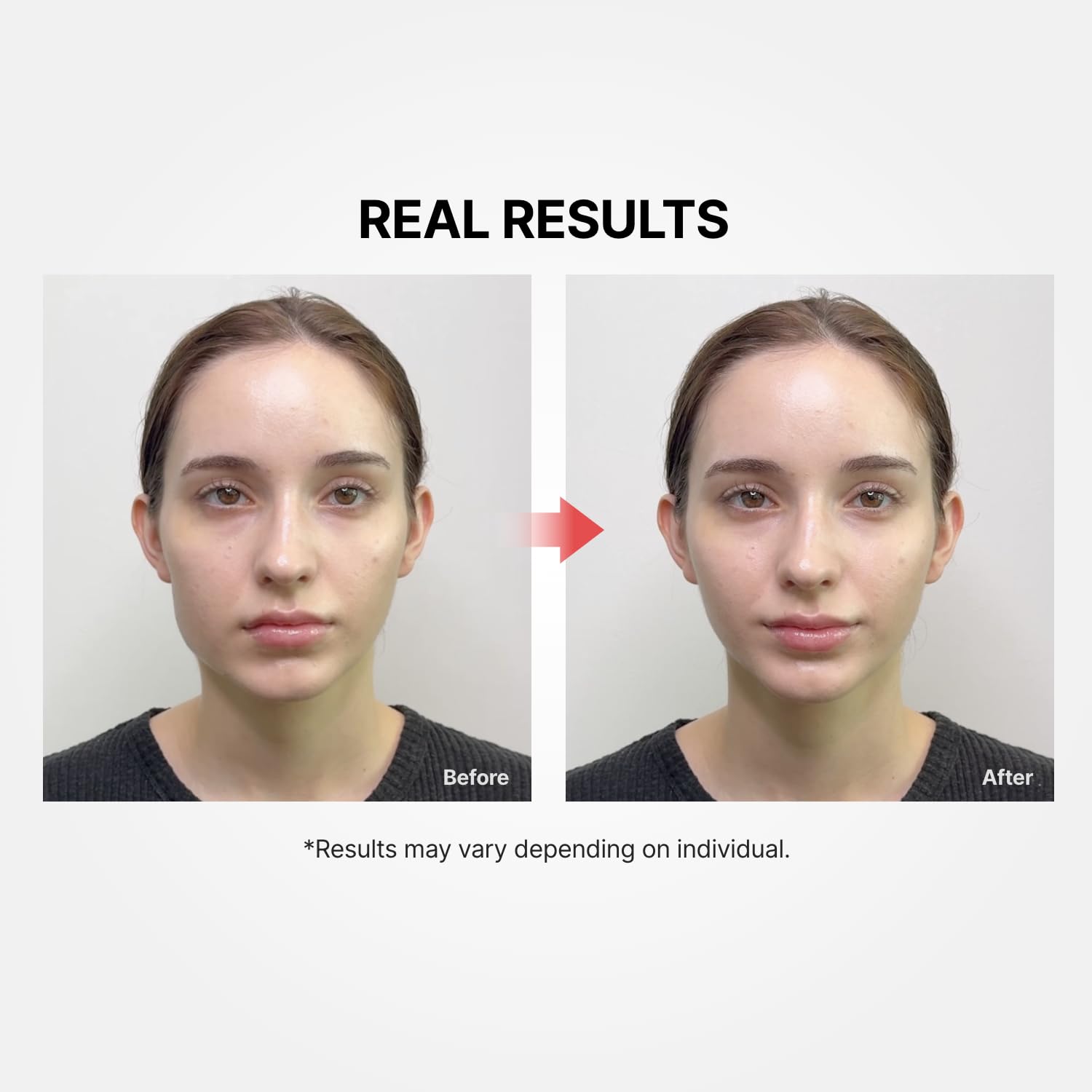 Shumage Gold Seal Lifting Cream+Device - Moisturizer Face Lift Cream, Hydrating & Tightening for Sagging Skin - Korean Face Moisturizer - Microcurrent Facial Device for Radiant Glow Skin - 1.69 Fl. Oz