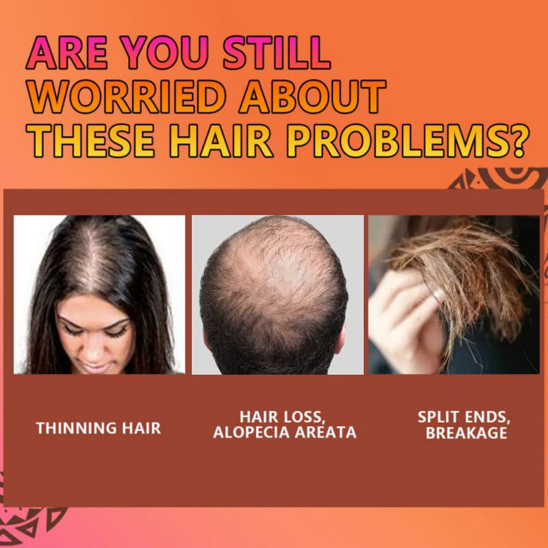 Hotiary Batana Oil Shampoo Bar for Hair Growth,Dr. Sebi Batana Oil Bar from Honduras, Natural Batana Bars for Prevent Hair Loss,Thickening (Red)