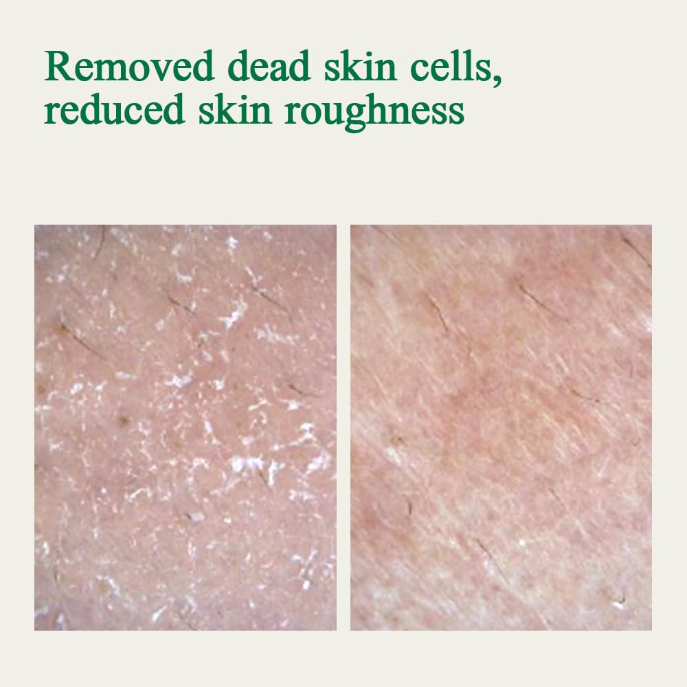 Pyunkang Yul [PKY] Ultimate Calming Solution Ampoule for Sensitive Skin with Patented Ingredients, Serum Intensely Calms & Soothes Redness with Cica & Tea Tree, Korean Skincare (1.01 Fl. Oz, 30ml)