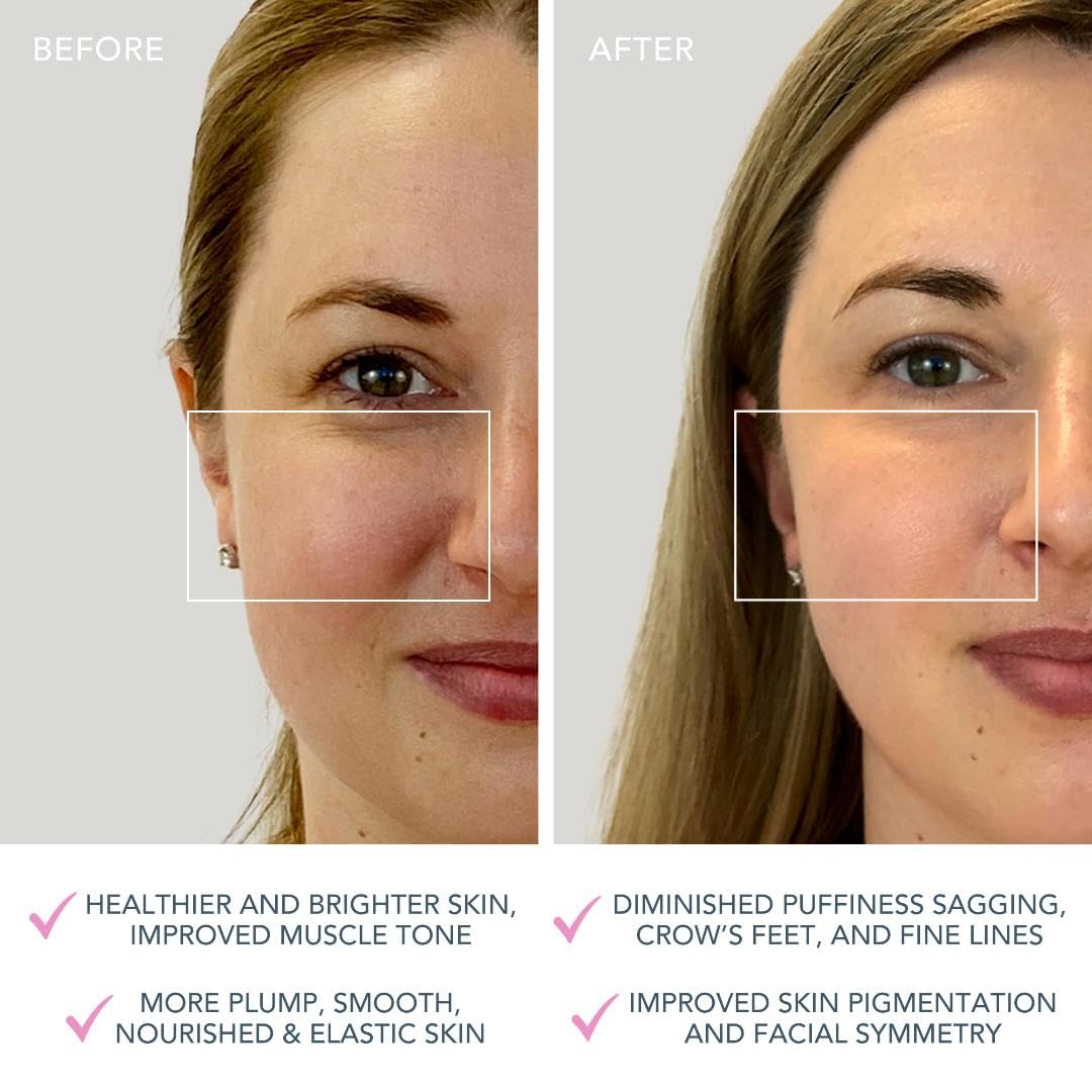 FOREO BEAR mini App-connected Microcurrent Facial Toning Device with 3 Intensities, Pearl Pink