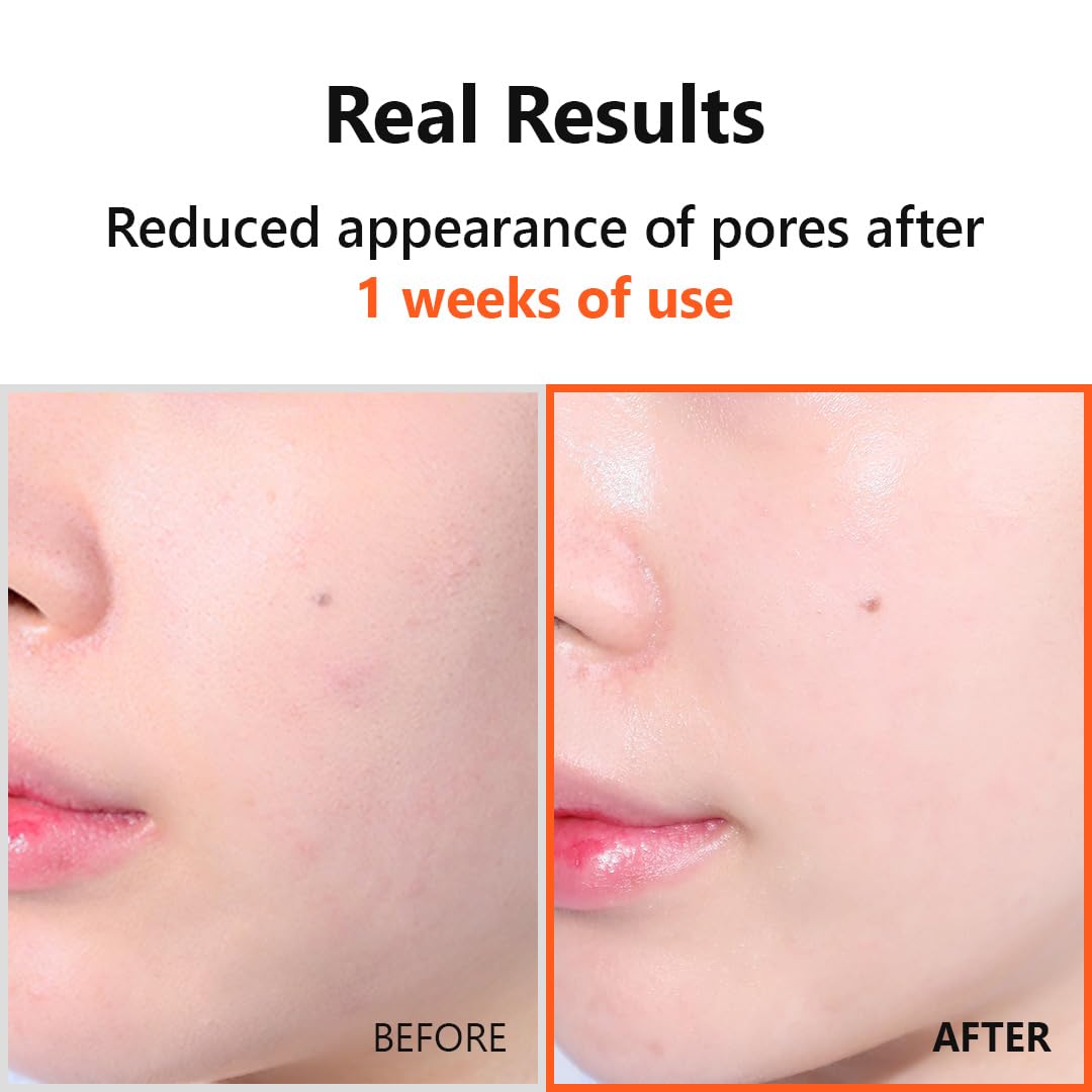 ISNTREE Hyper Niacinamide 20 Serum 20ml | 10x Hyaluronic Acid | Helps Minimize Pores | Evens Skin Tone | Korean Skincare