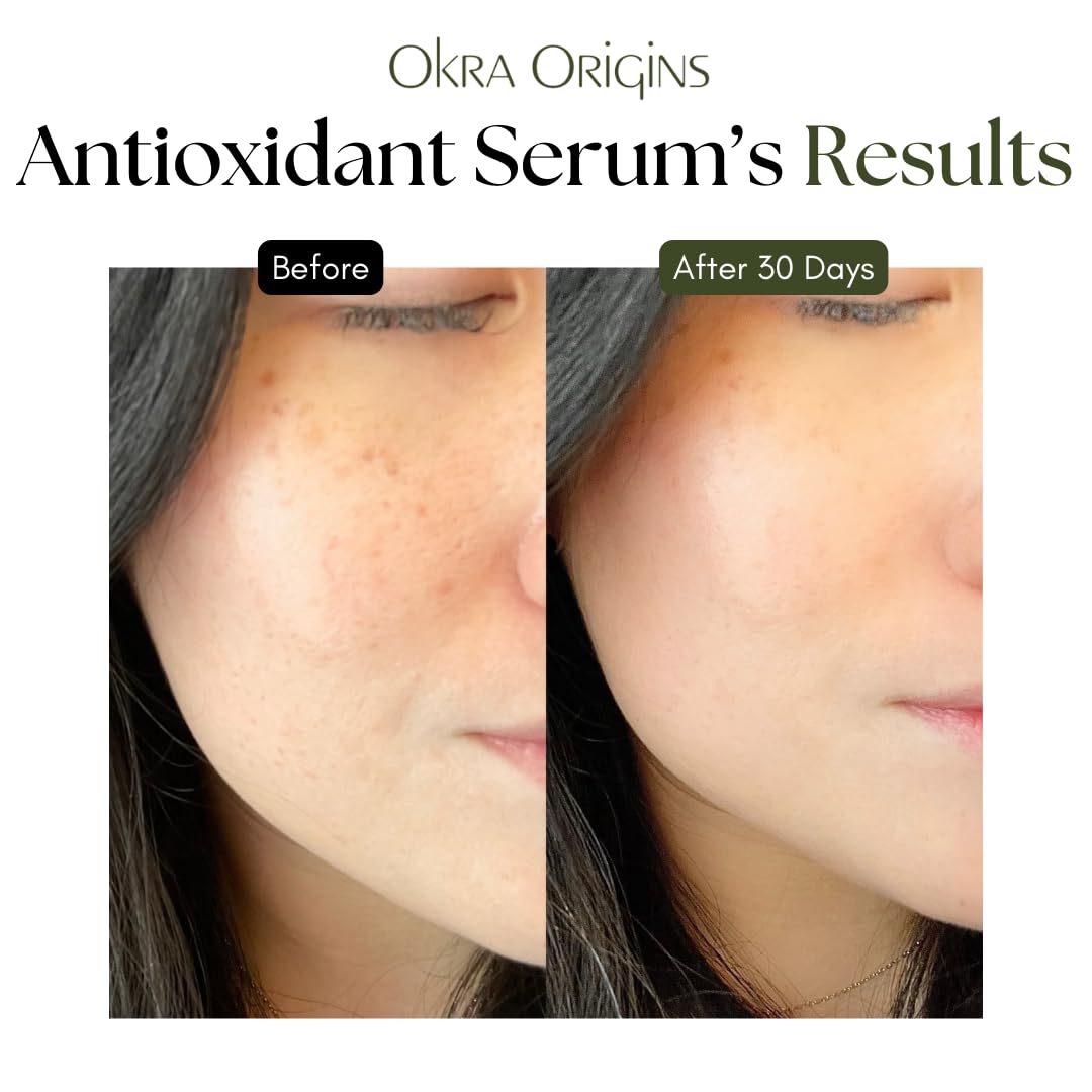10x Antioxidant Serum for Face | Hyaluronic Acid, Niacinamide, Green Tea, Aloe Vera, and More | Hydrating Lightweight Nourishing Sap