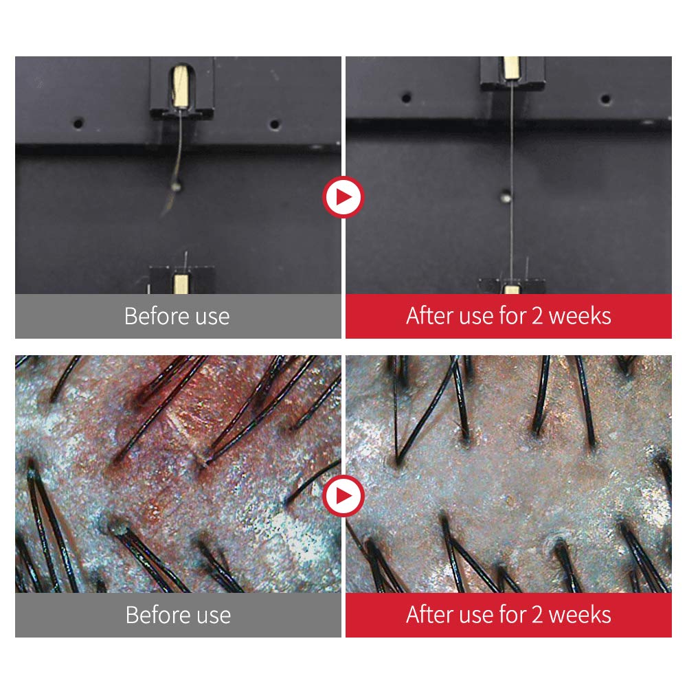 JSOOP Red J Shampoo 500ml / Anti-Hair Loss, Low Skin Irritation, Reduces Redness of The Scalp