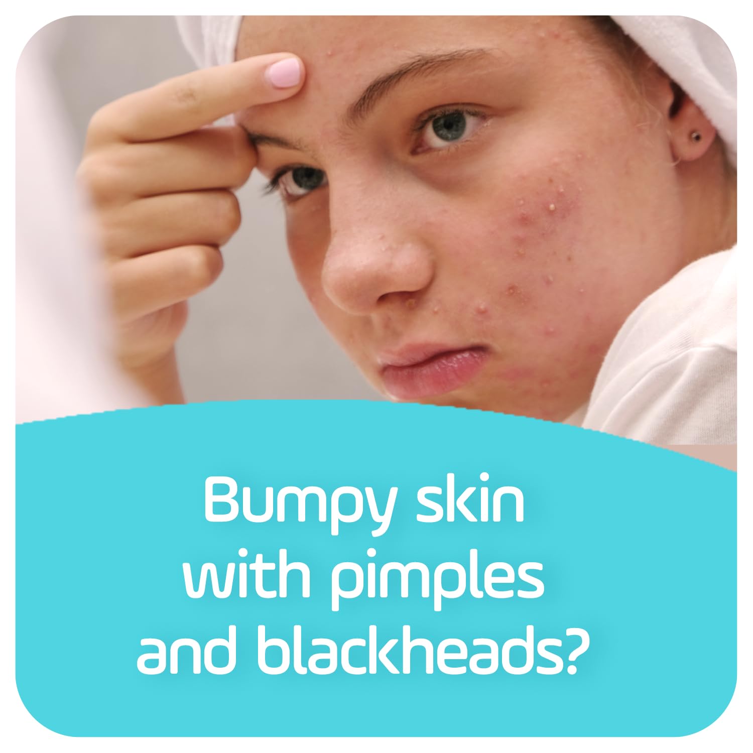 ASEPXIA SOAP SCRUB BAR 4OZ