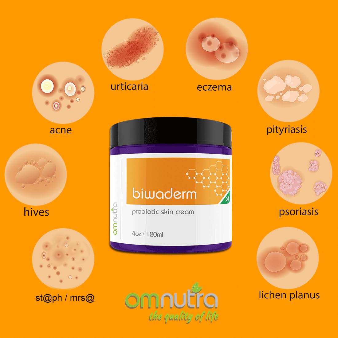 OmNutra Biwaderm Probiotic Skin Cream - 4OZ Organic Based Topical Probiotics for Skin Care Eczema Treatment Psoriasis Treatment for Folliculitis Treatment Pure Aloe Vera Gel 4oz