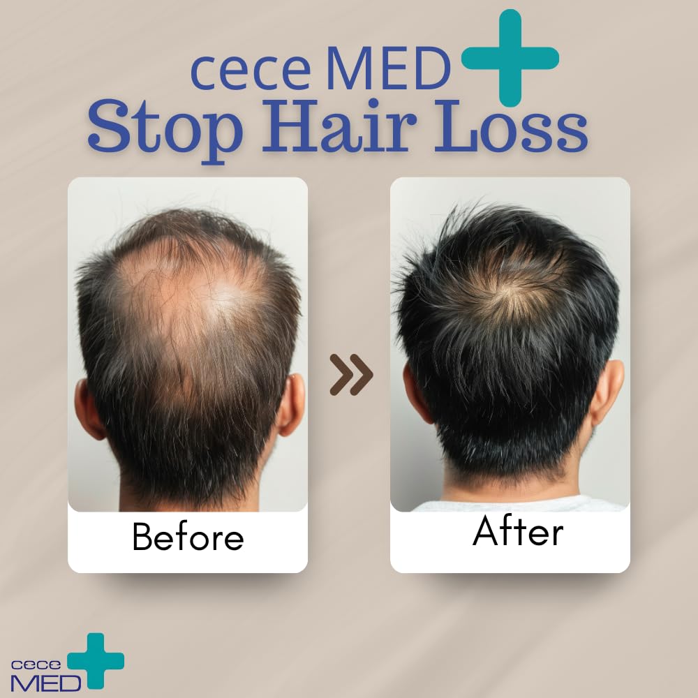 Cece of Sweden Stop Hair Loss Shampoo, Strengthens Scalp Collagen, Reduces Hair Loss, Boosts Volume, Long-Lasting Concentrated Formula, 10.1 fl oz, For Men and Women