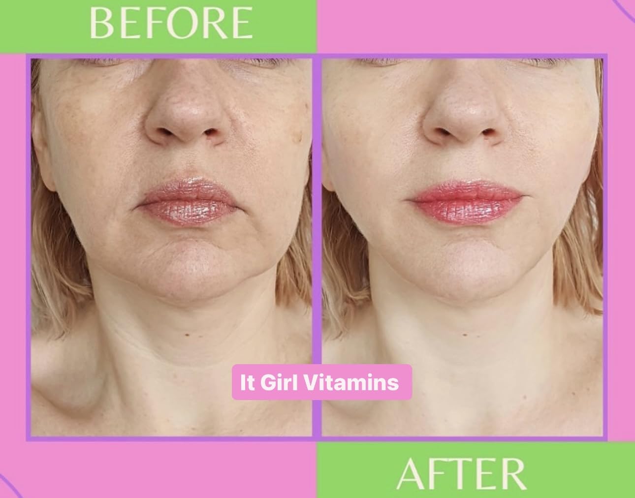 Multi Collagen Peptides Gummies for Women, Vegan Skin Supplement - Retinol, Hyaluronic Acid, Sea Moss, Vitamin C & Antioxidants for Anti-Aging, Hydration, Glow, Acne, Spots, Edible Korean Skin Care