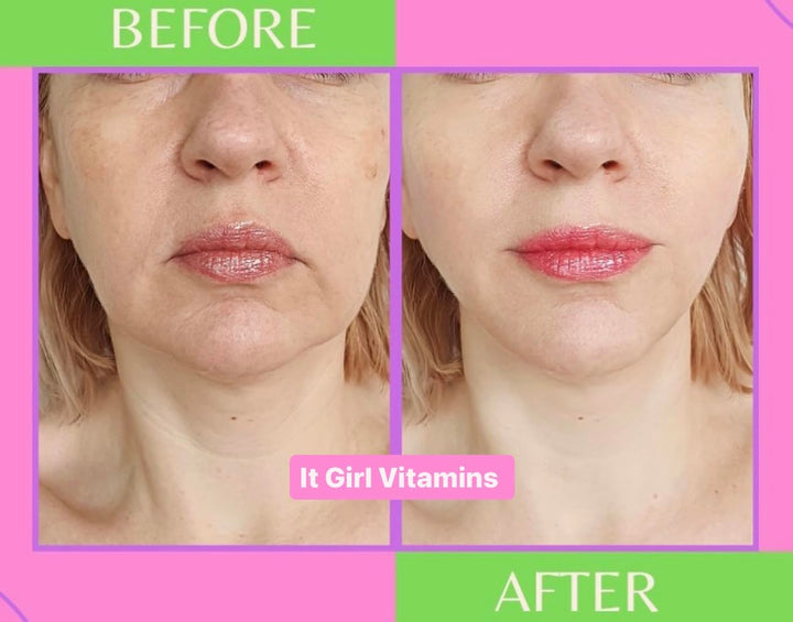 Multi Collagen Peptides Gummies for Women, Vegan Skin Supplement - Retinol, Hyaluronic Acid, Sea Moss, Vitamin C & Antioxidants for Anti-Aging, Hydration, Glow, Acne, Spots, Edible Korean Skin Care