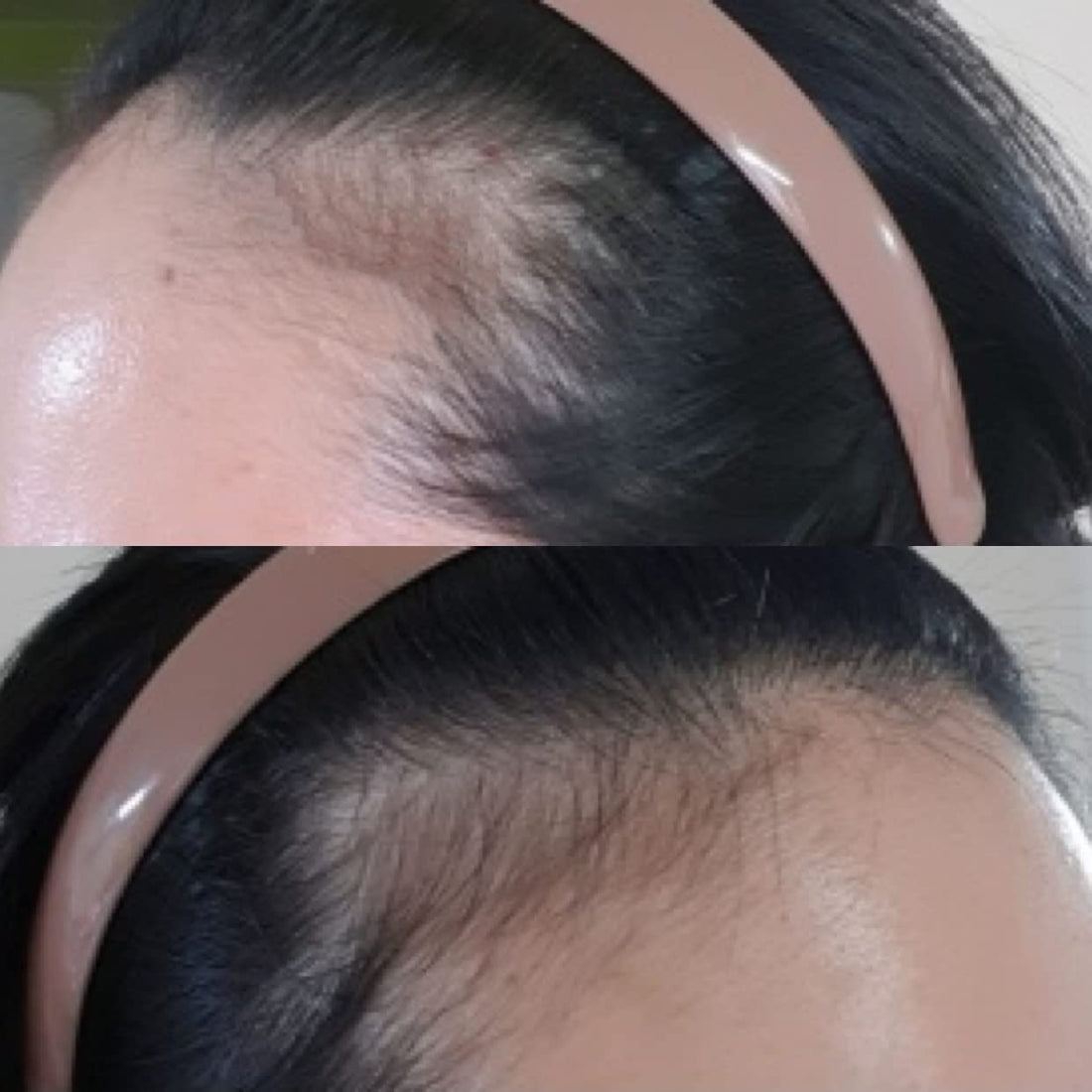 MIKROGAN Creme for EYEBROWS, AND BEARD CAFFEINE containing Intense Conditioning and Protection KERATIN, COLLAGEN and SILK to deliver nutrients and energy for FULLER facial hair, and for thinning Hair