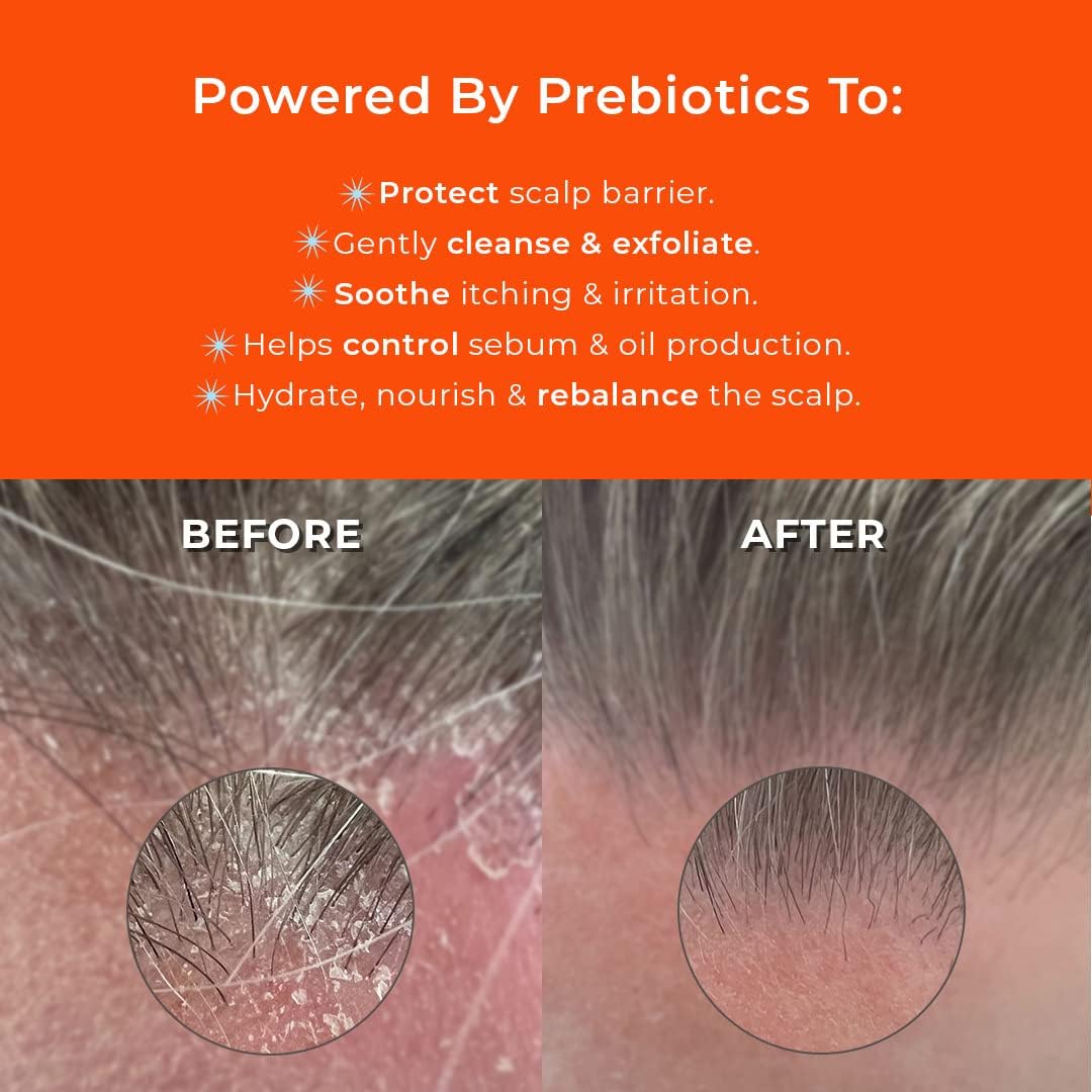 Straand Crown Cleanse Clarifying Shampoo - Itchy Scalp Detox Shampoo with Peppermint Oil & Prebiotics - Hydrates Dry Scalp & Balances Your Microbiome for Healthy, Shiny Hair (11.8 oz)