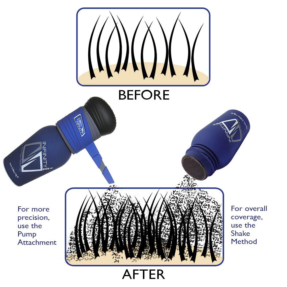 Infinity Hair Fibers for Thinning Hair (WHITE) For Women & Men - 100% Undetectable Fibers - 30g Bottle - Completely Conceals Hair Loss in 15 Seconds