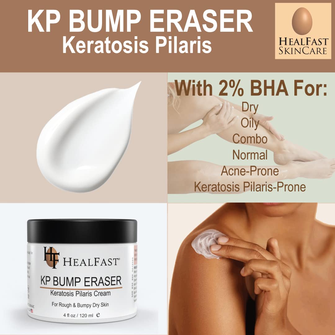 HealFast KP Bump Eraser Cream 4 Oz – Soften, Nourish Rough and Bumpy Skin with 2% BHA – Keratosis Pilaris - For All Types – No Scrubbing Required – Fragrance and Paraben Free