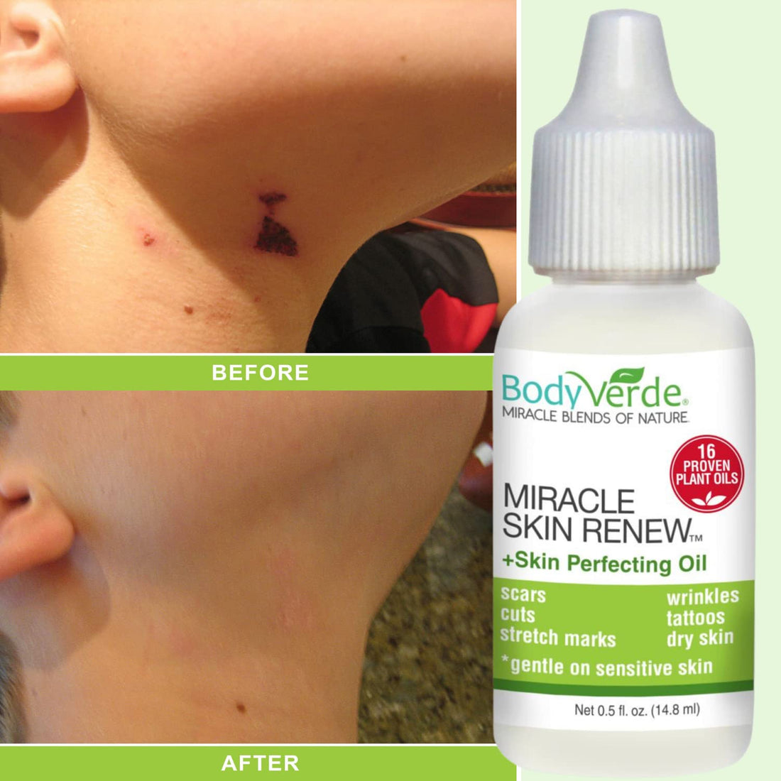 BodyVerde Miracle Skin Renewal Natural Skin Care Product, Skin Repair for Children and Adults, Healing Jojoba Oil and Coconut Oil Serum, Skin Perfecting Oil, 16 Proven Plant Oils, 0.5-Ounce