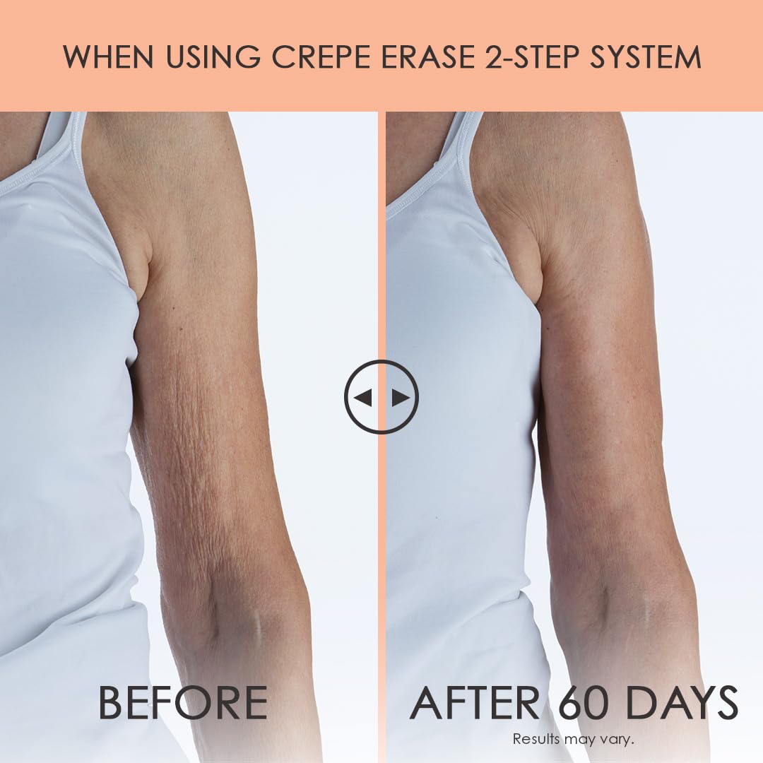 Crepe Erase 2-Step Advanced Body Care Treatment, Anti-Aging Skin Care for Body/Neck, Firming Moisturizer Cream + Body Exfoliating Pre-Treatment, Supports Wrinkle, Crepe Skin, Collagen, Fragrance Free