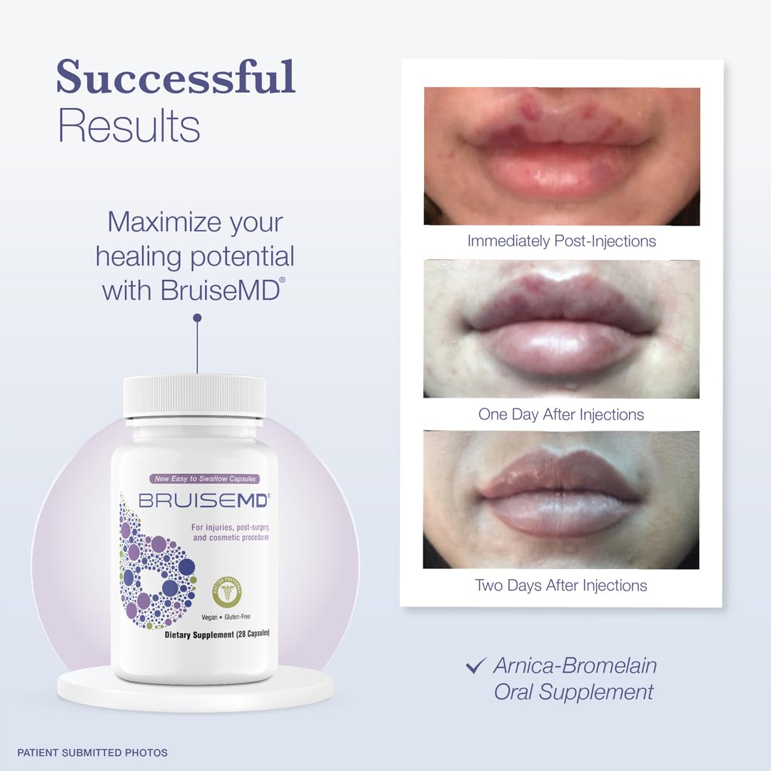 BruiseMD Arnica 1,000mg and Bromelain 500mg 2,400GDU/g Supplement for Bruising and Swelling, Easy to Swallow Capsules (7-Day Supply) - Advanced Bruise Treatment Formula