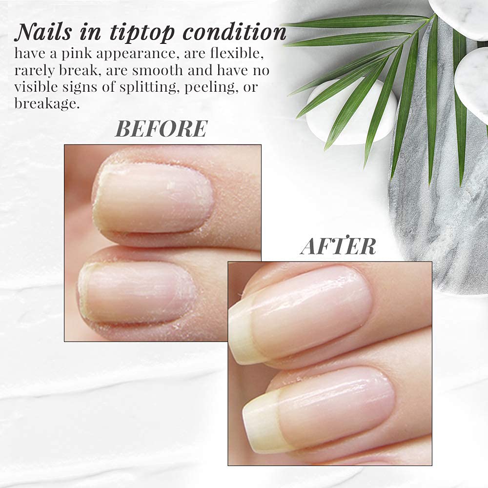 Nailtek Hydration Therapy for Strong Healthy Nails, 0.5 Fluid Ounce