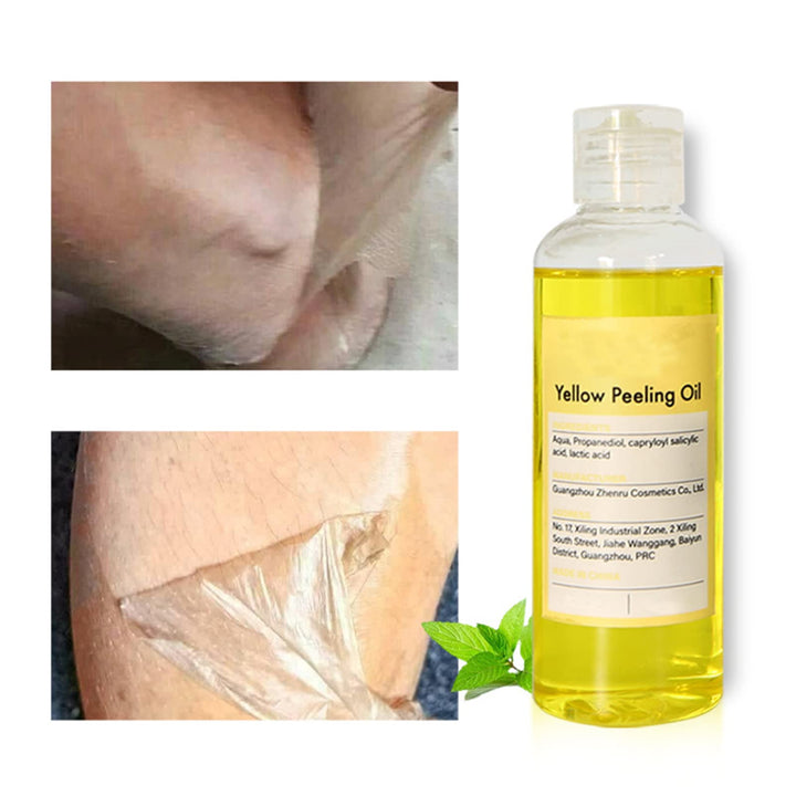 Generic Exfoliating Gel, Yellow Peeling Oil Extra Strength, Brightening Face & Body Scrub, Ordinary Peeling Solution for Dark Skin and Dark Spots (1.8 OZ)