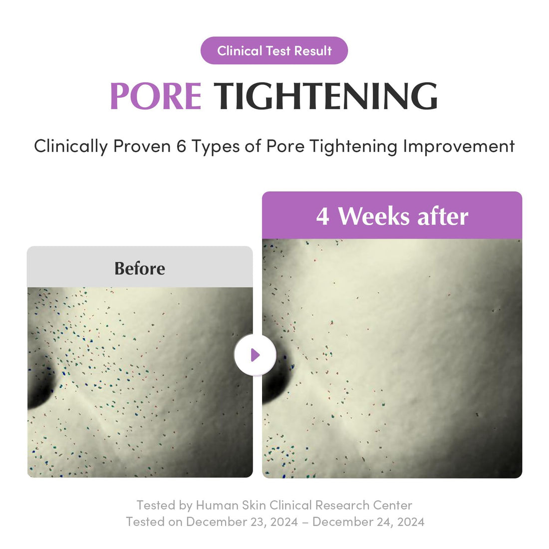 EQQUALBERRY Purple PDRN Pore Minimizing Serum – Vegan Collagen & Peptides for Pore Refining & Skin Elasticity | Niacinamide & CICA Exosome for Calming | Korean Glass Skin, 1.01 FL OZ