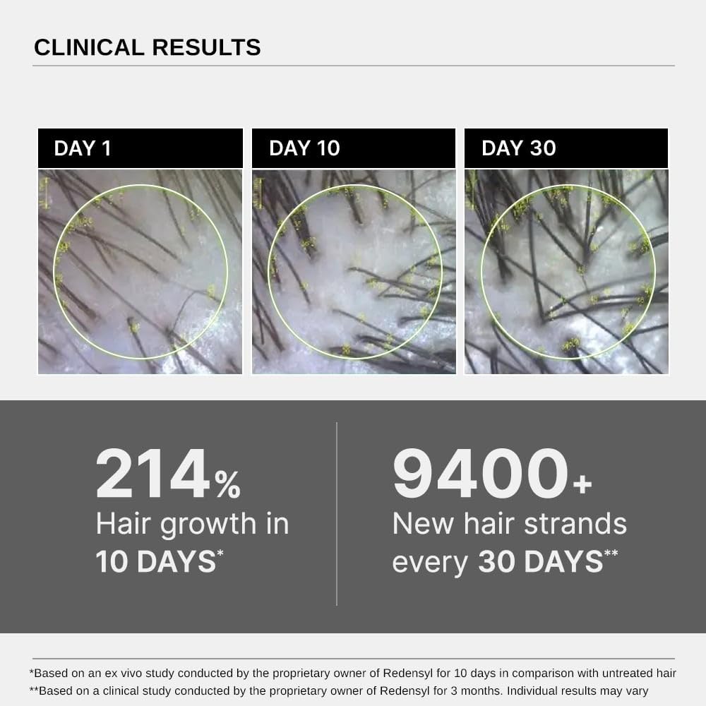 Bare Anatomy Advanced Hair Growth Serum| 3% Redensyl - 2x Better Results than Minoxidil | + 4% Anagain + 3% Baicapil | Rosemary, Biotin | Hair growth & Hair fall control serum for Women & Men | 30mL